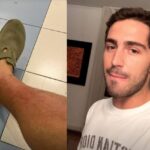 Tommaso Zorzi in ospedale per sospetta trombosi, ma la diagnosi sconvolge tutti