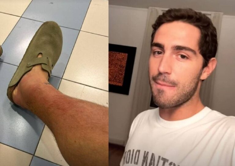 Tommaso Zorzi in ospedale per sospetta trombosi, ma la diagnosi sconvolge tutti